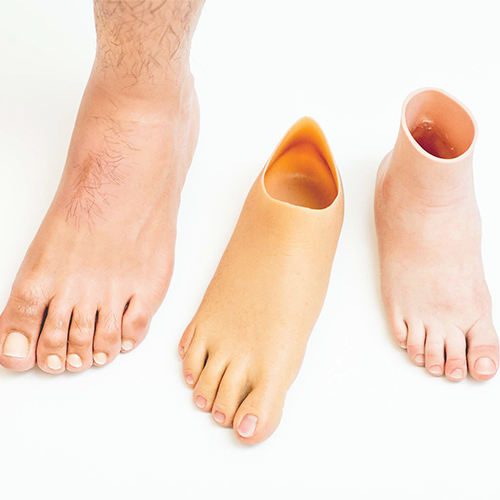 Lower Limb Cosmetic Silicone